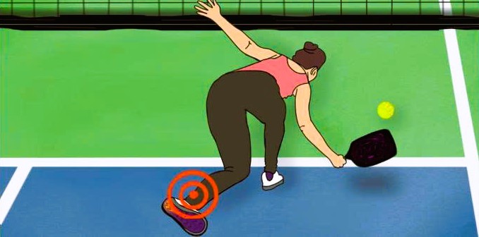 Chuyên gia đưa ra lời khuyên để tránh chấn thương khi chơi pickleball